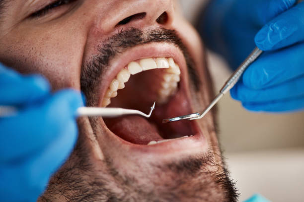 Dentist for Dental Trauma in IL